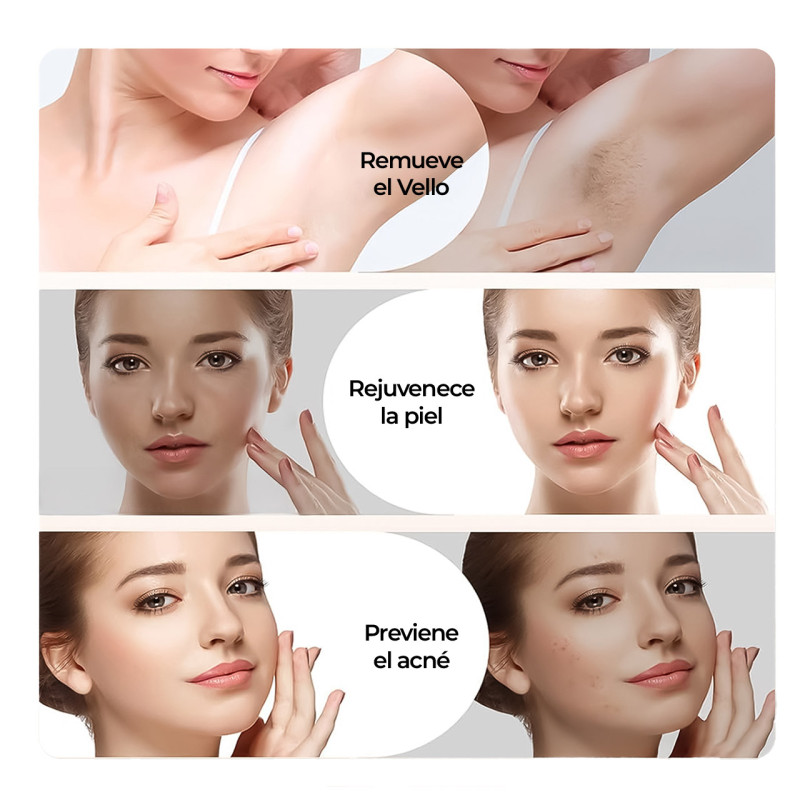 Depiladora Láser Bye Bye